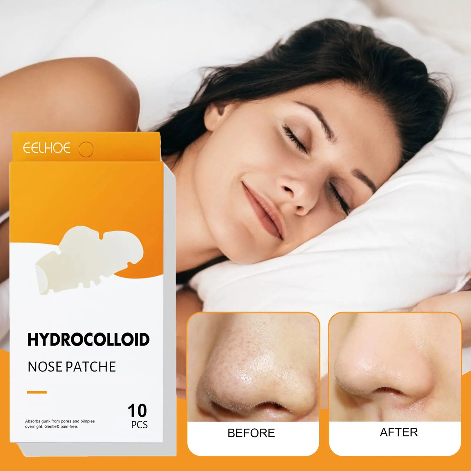 Blackhead & Acne Removal Strips