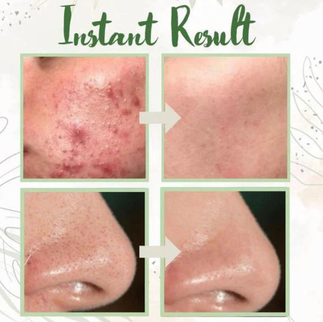 Green Tea Deep Cleanse Mask