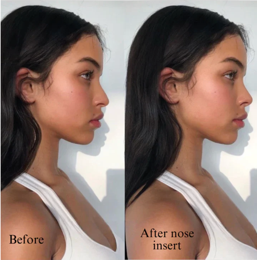 Nose Shaping Insert