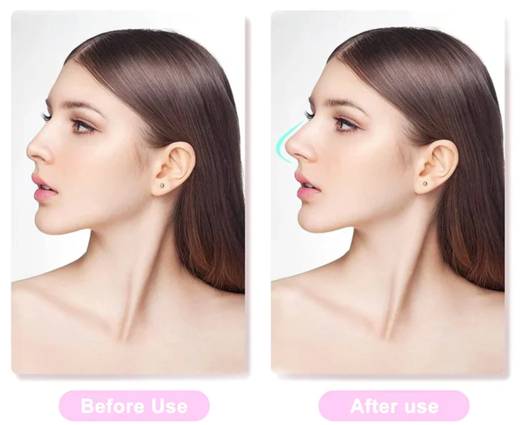 Nose Shaping Insert