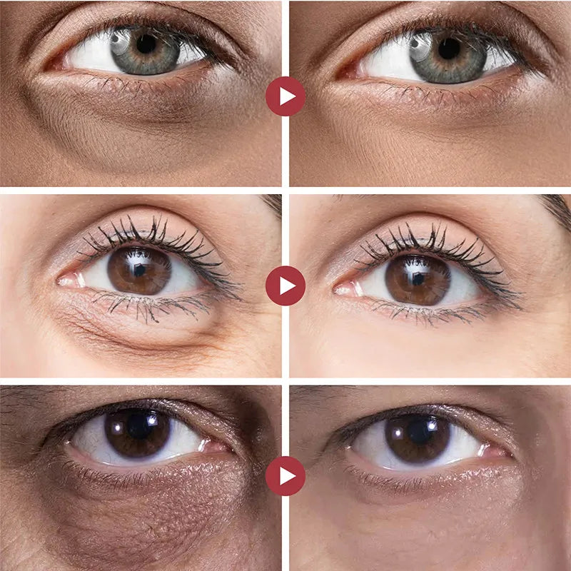 Instant Eye Tightener